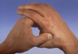 Photo of two hands